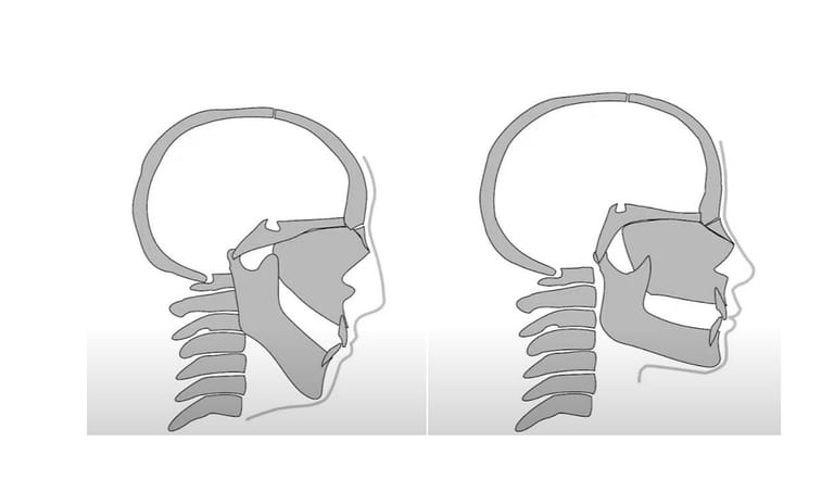 Mewing: what is this anti-double-chin technique? — Typology