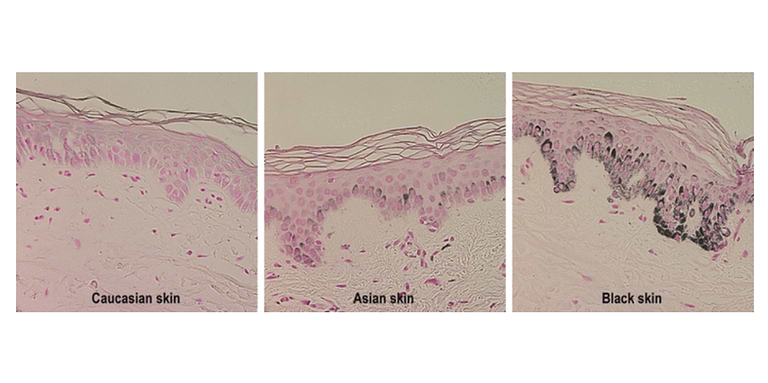 What are internal and external photoprotections? — Typology