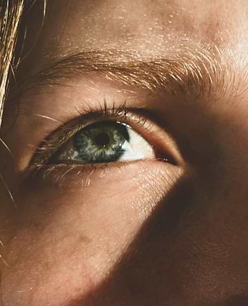 White eyebrows: what caus