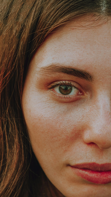 Petechiae: what are the c